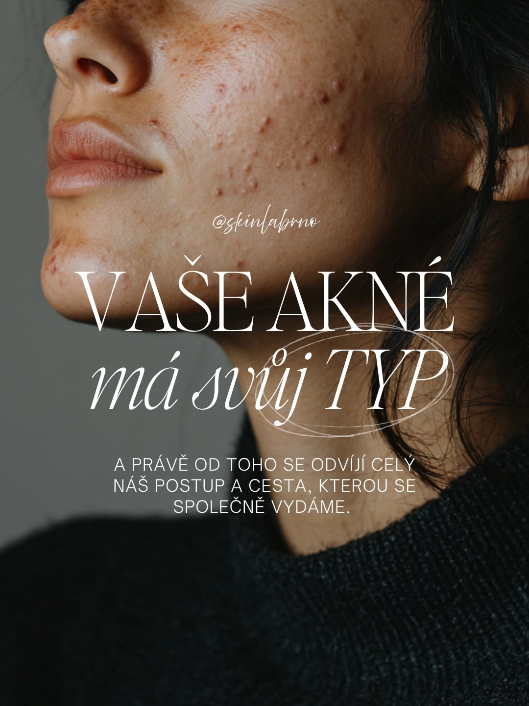 SkinLab Brno — Instagram